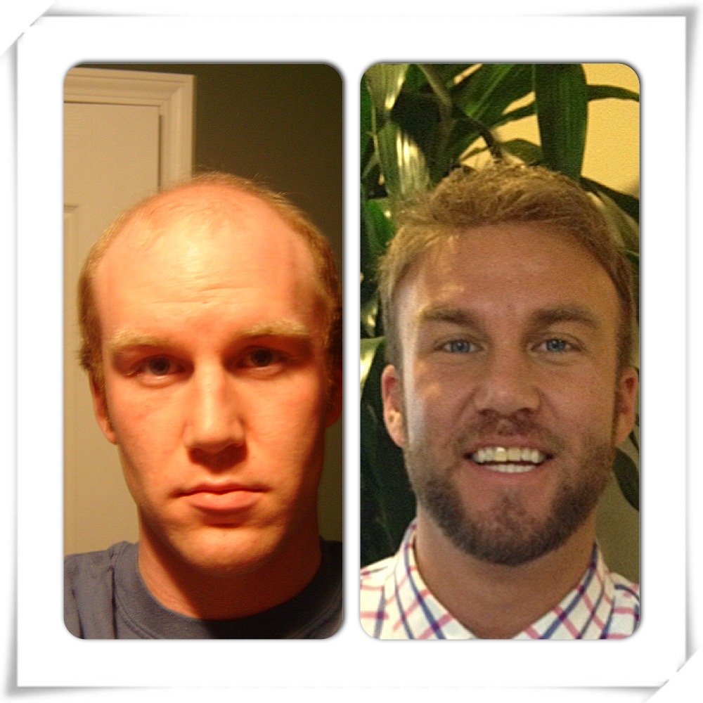 Monarch client transformation — before and after